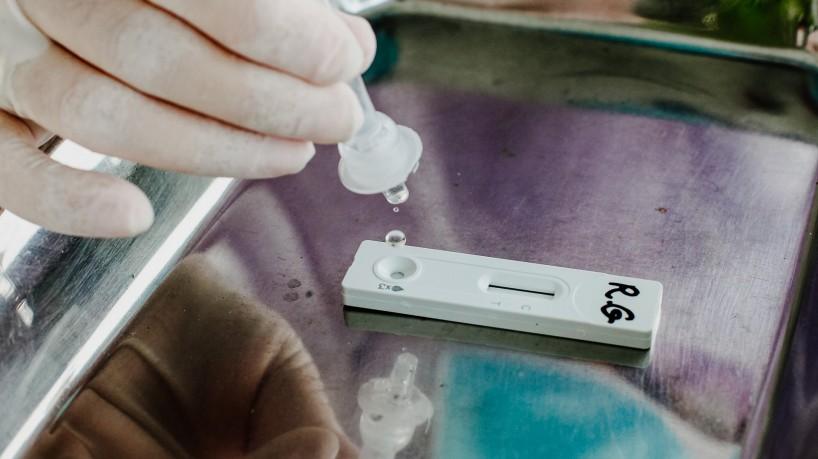 Centros de Testagem para Covid-19 serão fechados no Ceará